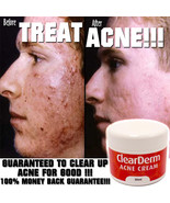 THE NO.1 CLEAR DERM ACNE CREAM, SCARS &amp; BLEMISH CREAM, CLEAR SPOTS - $535.74 MXN