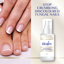 Idealex ANTI-FUNGAL Nail Treatment Stop Crumbling Discoloured Fungal Nails - £21.43 GBP