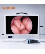 24 Inch Monitor 1080P Full HD Medical Endoscope Camera with 80W Light So... - £2,925.69 GBP