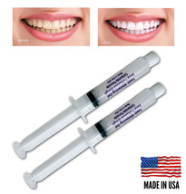 Always White Teeth Whitening 2 Syringes 35% Gel Professional Tooth Bleaching   - $8.95