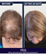 FEG1 Hair Growth spray hair loss Prevent Hair Damage &amp; Hair Loss Spray - $17.80 CAD