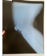 Real X-Rays Left Knee 3 Film Sheets for Education Art 14x17 Inches PII R... - $74.95