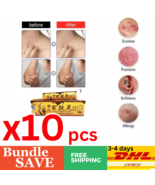 X10 PACKS Traditional Cream Eczema Herbal Cream Works Perfect For Skin P... - £70.23 GBP