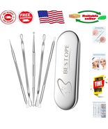 Travel-Friendly Blackhead &amp; Pimple Remover Tools - Durable Stainless Steel - $15.93 CAD