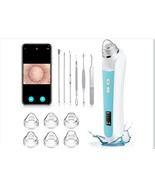 Blackhead Remover Vacuum with Camera - 6 Suction Heads, 3 Modes - USB In... - $50.22 CAD