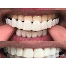Snap On False Teeth Upper + Lower Dental Veneers Dentures Tooth Cover Se... - £13.66 GBP