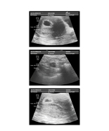 FakeaBaby Prank Fake Ultrasound 3-4 Week Fake Sonogram Emailed Today!  - $9.99