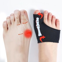 Hygger Bunion Corrector for Men &amp; Women | Bunion Pads &amp; Foot Sleeve | En... - $9.99