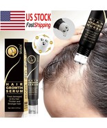 Sevich Ginger Hair Growth Oil Thickener Essence Hair Loss Care Scalp Hai... - $17.99