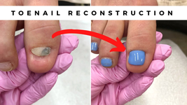 Fuzion UV/LED Nanoflex Conceal Toe Nail Restore Sampler Kit image 4