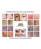 Photo Rajeunissement Hyper Pigment Age Spot Removal 1064 Laser. - $999.95