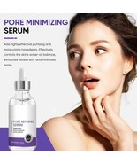 Pore Refining Serum – Shrinks Pores, Tightens Skin &amp; Removes Blackheads ... - $407.92 MXN