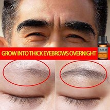 Eyebrow Fast Growth Oil Eyelash Growth Essential Oils Essence  Anti Alopecia Pro - $19.01