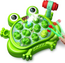 Hoperock Toys For 2 3 4 5 Year Old Boy,Toddler Toys Age 2-4, Whack A Frog - $42.98