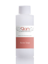 Skin Obsession 2 oz Acne Stop -Treats Acne Blemishes &amp; Prevents future O... - $21.99