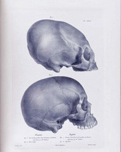 Vintage Skull Enlongation Anatomy Medical New Painting Giclee Print Canvas - £8.21 GBP+