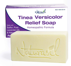 Tinea Versicolor Treatment Max-Strength 10X Soap | Antifungal Micronized Sulfur - £17.71 GBP