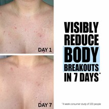 Glycolic Acid Exfoliating Body Stick - $41.92