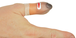 BRUISED THUMB - $32.21