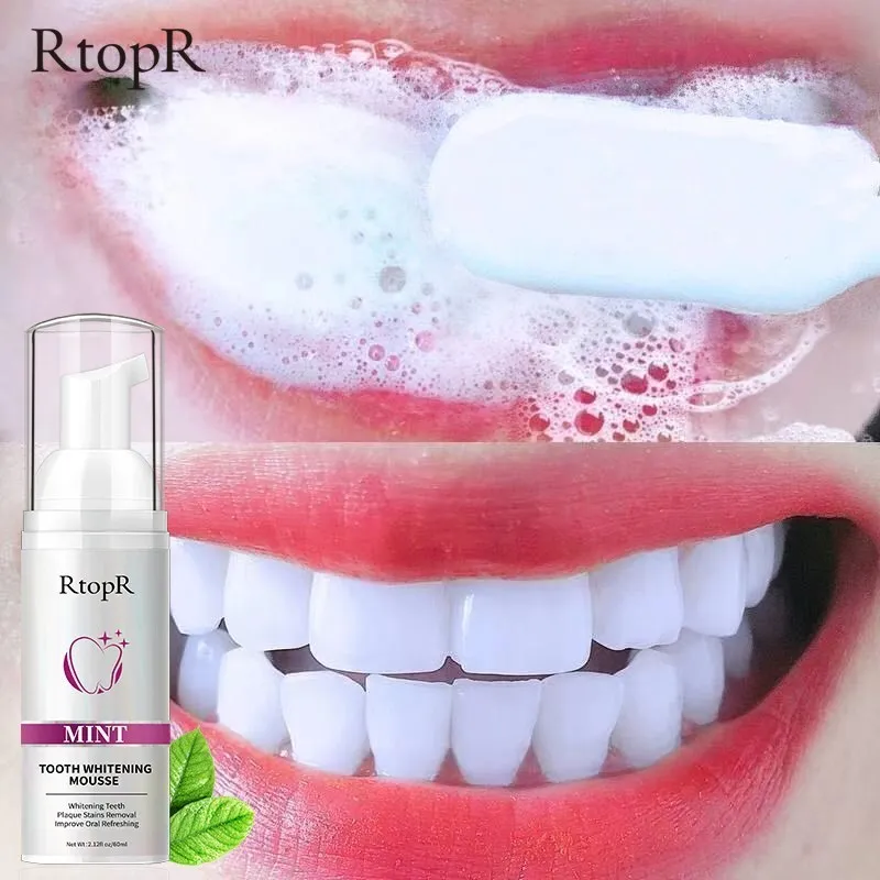 House Home Mint Teeth Whitening Mousse Removal Aular Removal Smoke Stains Remova - £24.32 GBP