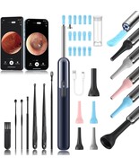 Ear Wax Removal - 3in1 Wireless WiFi Rechargeable Ear Cleaner Kit 1080P ... - $589.04 MXN