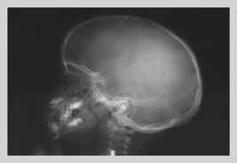 Skull 20 x 30 Poster - $25.98