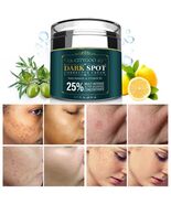 Crema Blanqueadora Antiarrugas Elimina Manchas Cara Axilas Cuerpo Rodill... - $34.91