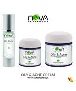 Oily &amp; Acne Cream By Nova Skin - £31.60 GBP+