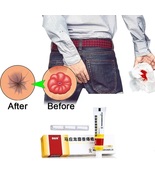 10/20Box Mayinglong musk Hemorrhoids Ointment, Hemorrhoid cream 10g/Box - $797.26 MXN+