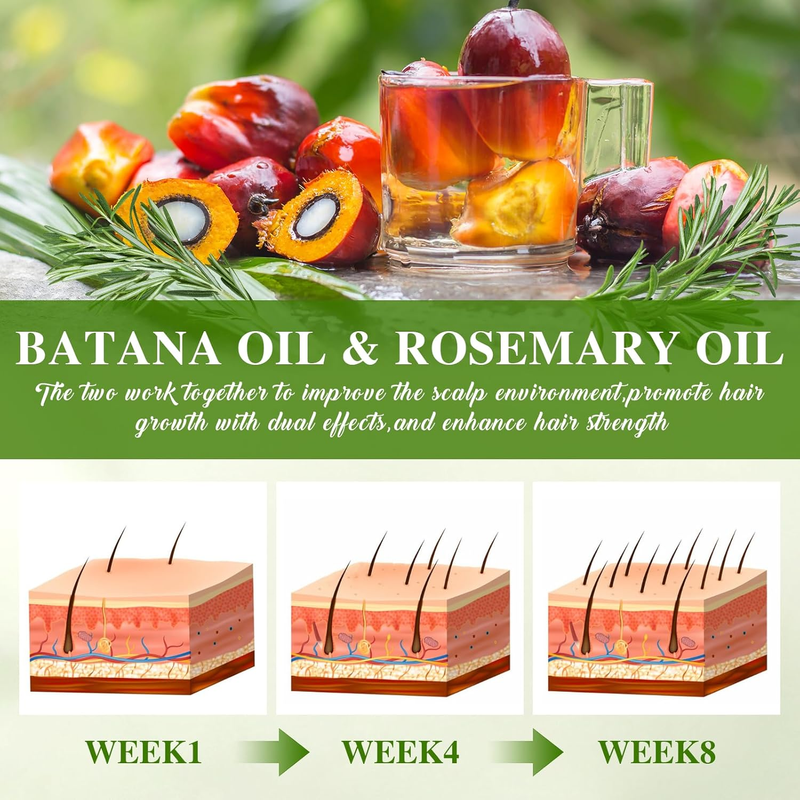 Batana Oil for Hair Growth and Rosemary Oil for Hair Growth, Nourish Dry Damaged Item image 6