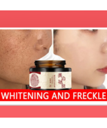 Crema Blanqueadora Para Elimina Manchas Y Acne De La Cara Crema Efectiva - $18.82