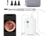 Ear Camera with Ear Wax Removal Tools, Video Ear Scope Otoscope with Light - $101.97