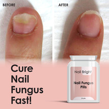 Nail Bright Pills - Nail Fungal Cure Stop Fungus Dry Brittle Crumbing Nails - £21.92 GBP