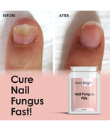 NAIL BRIGHT PILLS - NAIL FUNGAL CURE STOP FUNGUS DRY BRITTLE CRUMBING NAILS - £22.29 GBP