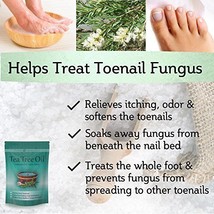 Tea Tree Oil Foot Soak Epsom Salt Treats Nail Fungus, Athletes Foot &amp; Fo... - $34.99
