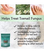 Tea Tree Oil Foot Soak Epsom Salt Treats Nail Fungus, Athletes Foot &amp; Fo... - £27.40 GBP