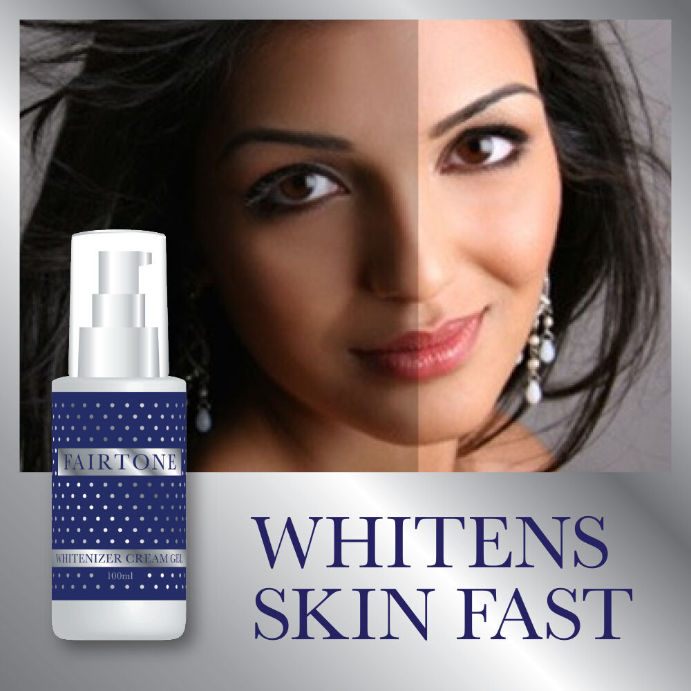 FAIRTONE WHITENIZER CREAM-GEL STOP DARK PATCHES WHITENS SKIN FAST CHLOASMA - $33.86