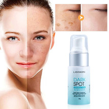 Dark Spot Corrector Remover - $34.18