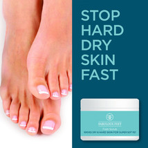 Fabulous Feet Foot Scrub Removes Dry &amp; Hard Skin For Super Soft Feet – Soothe - £22.06 GBP