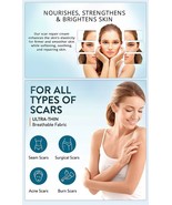 20g Tube Scar Removal / Repair Cream for Men / Women - $474.22 MXN