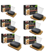 Natural African Black Soap w/Cocoa Butter &amp; Vitamin E For All Skin, (Lot... - £23.59 GBP