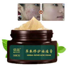 EFICAZ Crema para el acné ELIMINA Espinillas Espinillas Manchas hombres ... - $367.38 MXN
