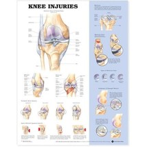 Knee Injuries Anatomical Chart Anatomical Chart Company (Editor) - £15.77 GBP