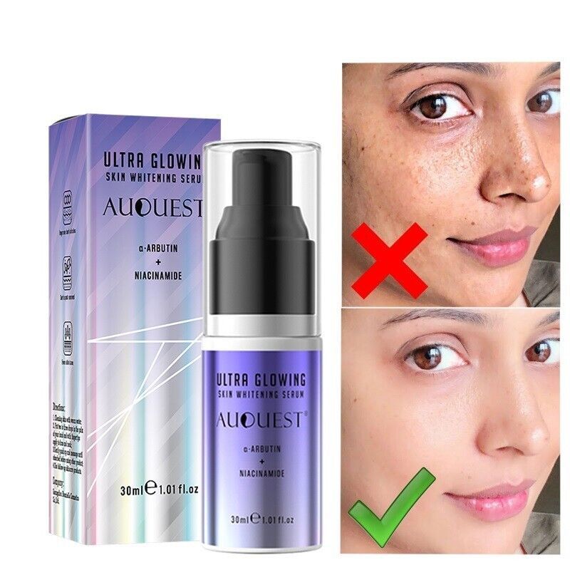 Dark Spot Remover Facial Serum Melasma Freckles Glowing Whitening Face Skin Care