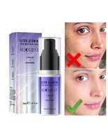 Dark Spot Remover Facial Serum Melasma Freckles Glowing Whitening Face S... - £13.19 GBP