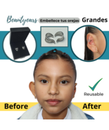 Protruding ear corrector EARCLIC - $50.00