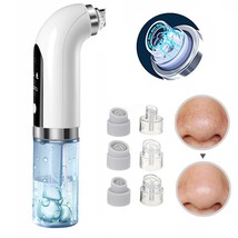 Blackhead Remover Pore Cleaner Beauty Device  - £20.20 GBP