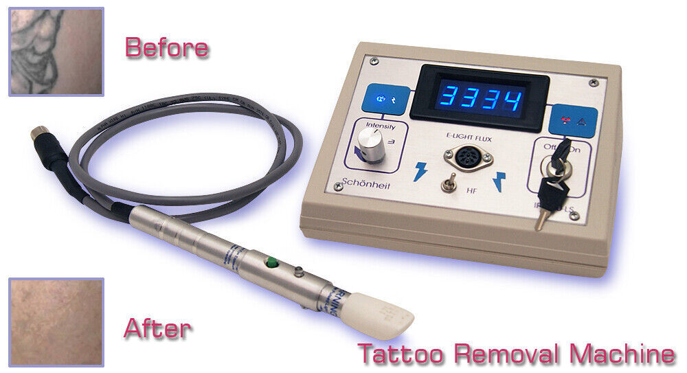 Bio Portable Tattoo Removal Advance, Machine and Gun, Best Laser System.. - $1,199.95