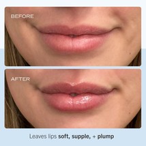 Ultra Repair Lip Balm - $566.25 MXN