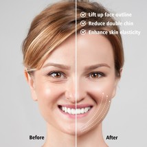Double Chin V Line Facial Lifting Device LED Rejuvenation Face Slimming Vi - £21.52 GBP